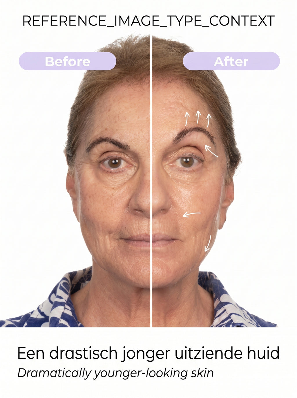 Lifting y Tonificador Facial Eléctrico