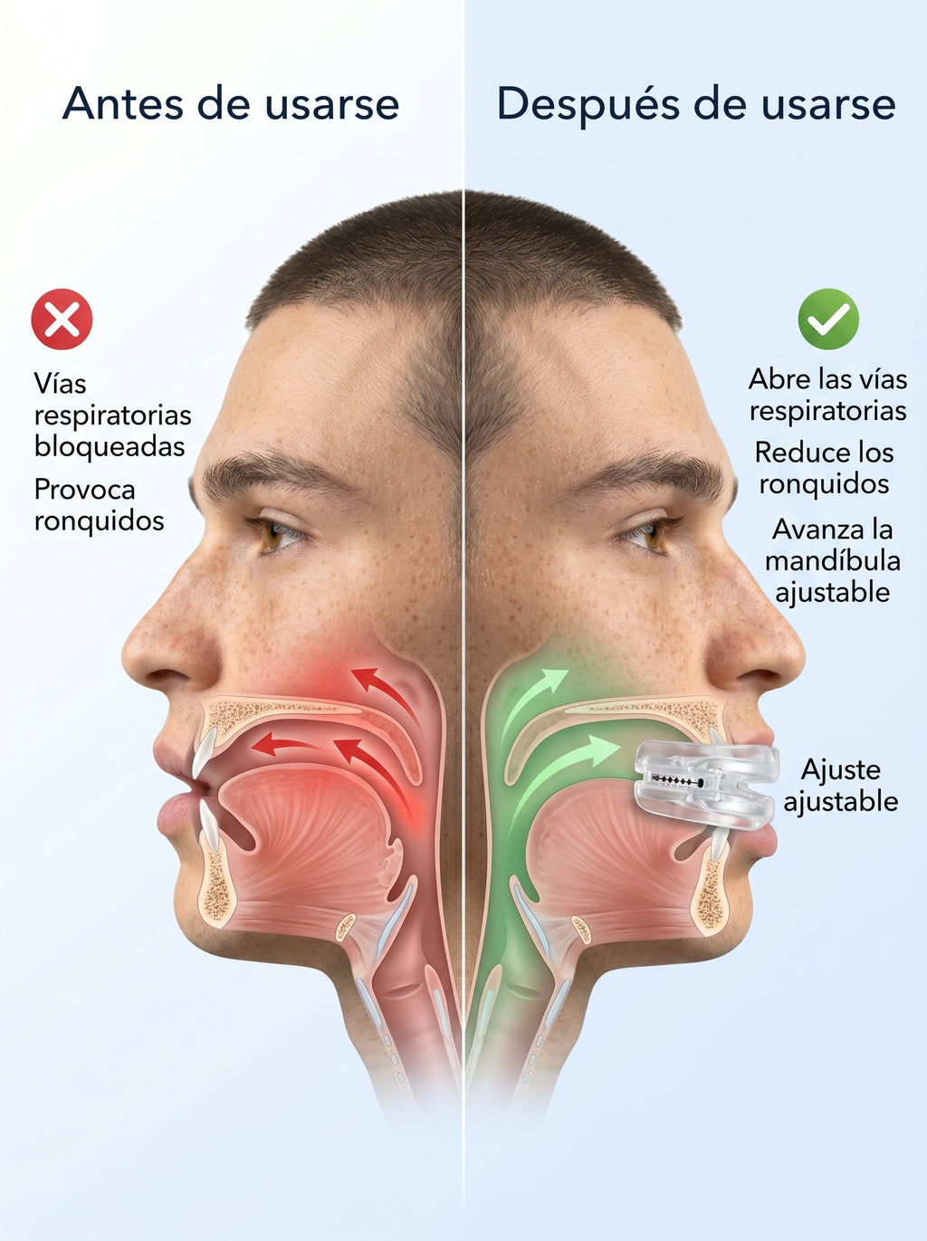Guarda Dental Ajustable Bruximo y Ronqui