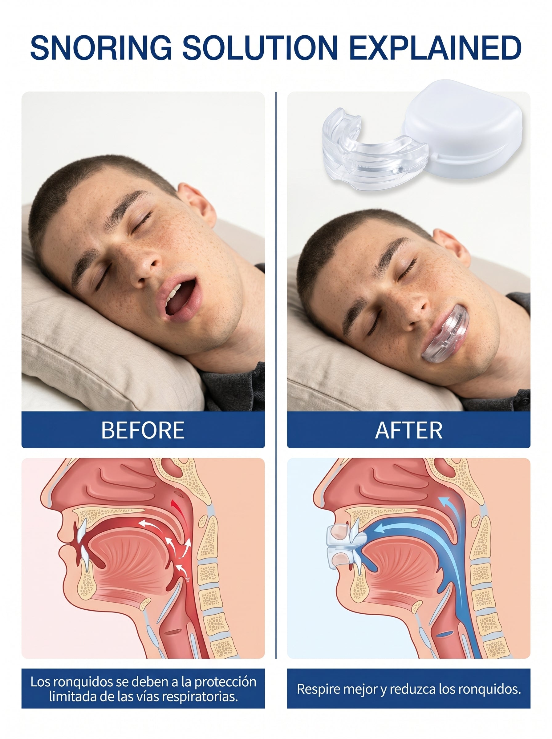 Guarda Dental Ajustable Bruximo y Ronqui