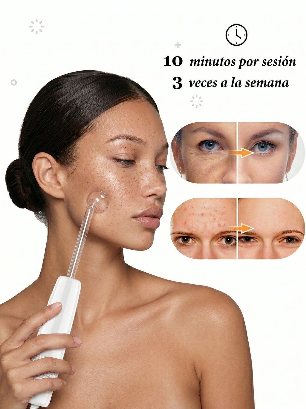 Dispositivo de Alta Frecuencia Facial